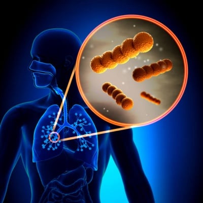Bacteriële Infecties