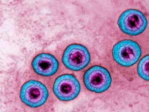 Genitale Herpes